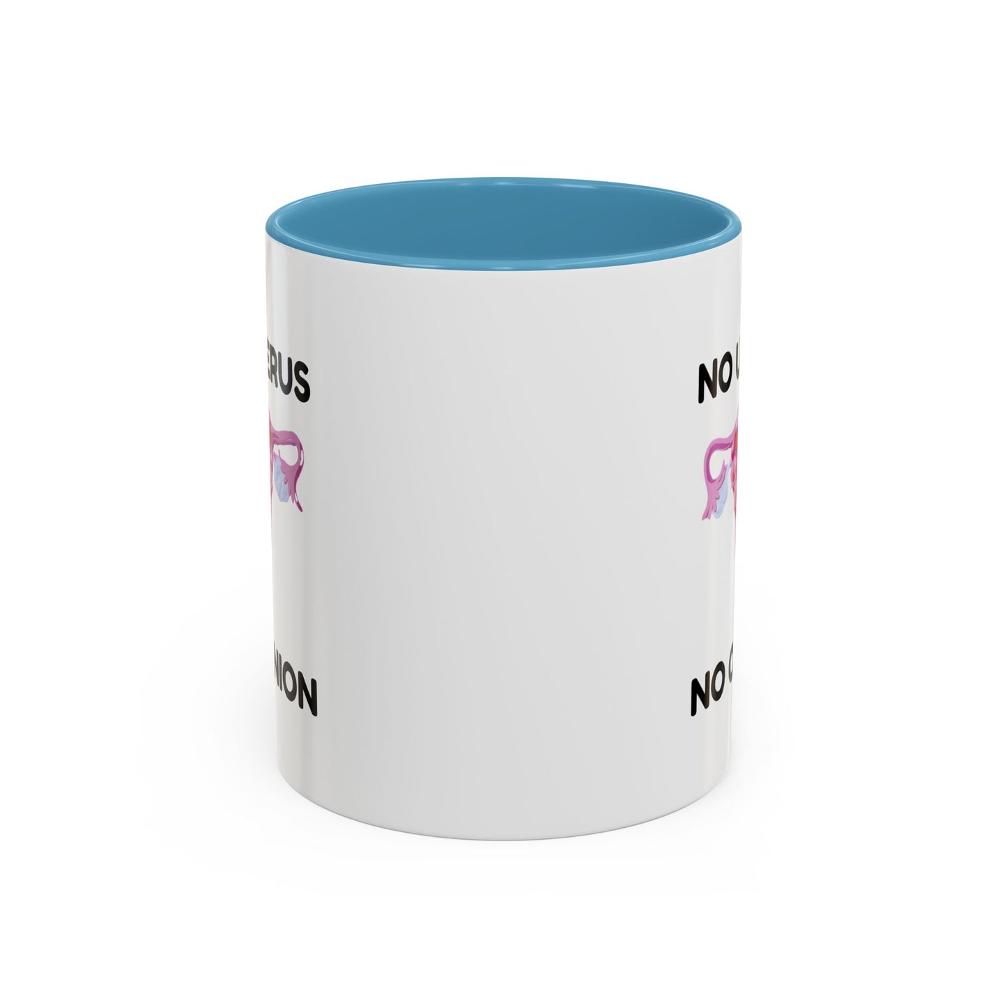 "No Uterus. No Opinion." Ceramic Two-Tone Mug